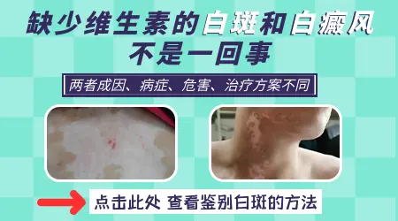 小孩缺少维生素的白斑图片