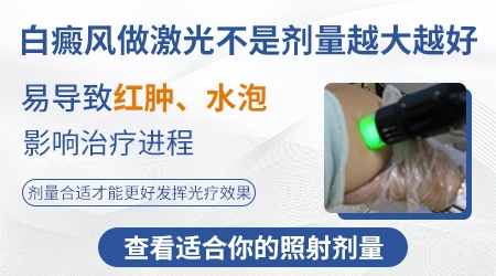 白癜风光疗剂量太大会不会加重病情