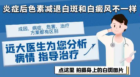 白癜风与炎症后色素减退的区别图片