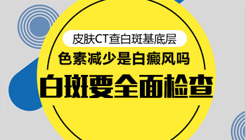 衡水脸上和身上的白斑怎么回事