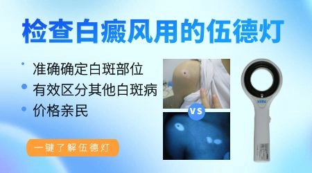 皮肤CT检查白斑准确率高吗