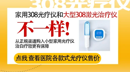 医用308和家用308区别 哪个照白癜风好得快