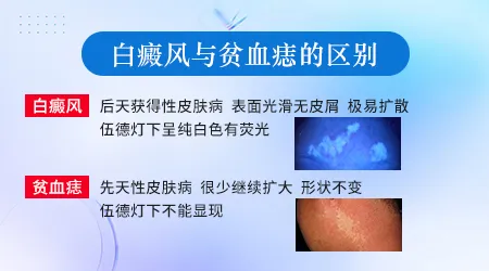 贫血痣和白癜风的白斑有什么不一样