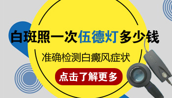 伍德灯下轻度白癜风检查结果