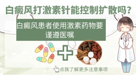 手上白斑用药后扩散了