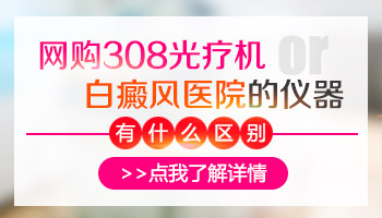 从网上买的308光疗仪照白癜风管用吗