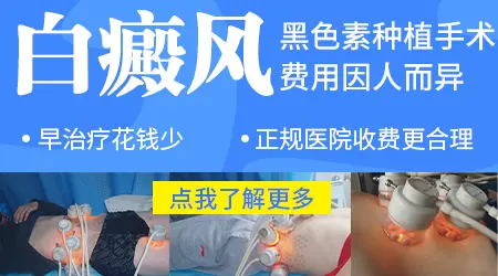 白斑种植黑色素的费用大概多少