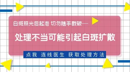 白斑光疗后出现水疱是正常反应吗 该怎么处理