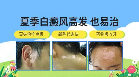夏天白癜风患者如何选择防晒霜