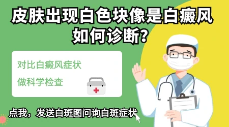 网上问诊能确诊白癜风吗 拍照片给医生够不够
