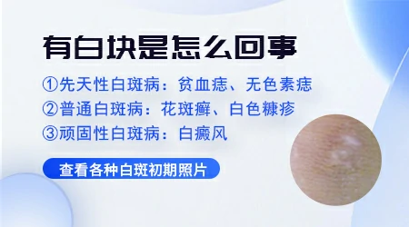 指甲盖大小的白块怎么回事