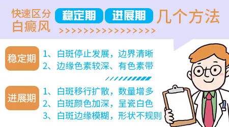 白癜风进展期和稳定期怎么区分