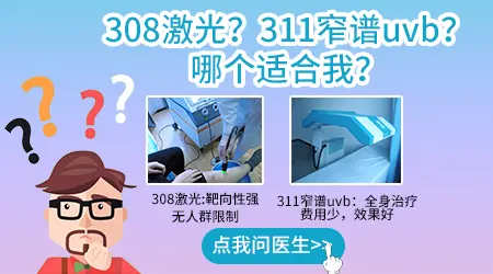 治疗初期白癜风照311紫外线还是308激光