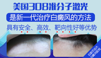 他克莫司0.1和0.03的区别 哪个用于成年人白癜风