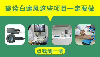 白癜风查一次就能确诊吗