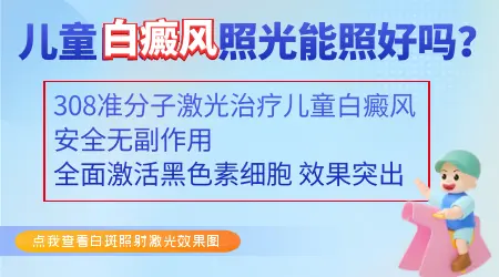 儿童白癜风照光有没有效果