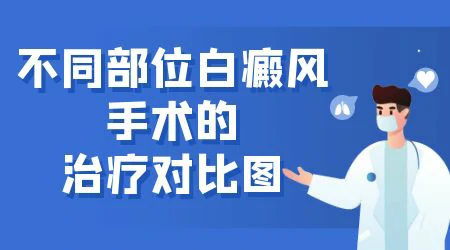 白癜风植皮手术失败怎么补救