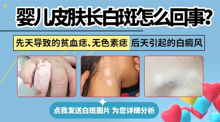 新生儿大腿内侧皮肤发白怎么回事