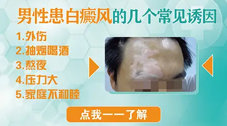 男性头皮上出现一块乳白色怎么回事