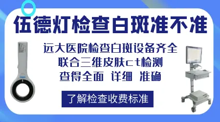 伍德灯下白斑显示亮白色就是白癜风吗