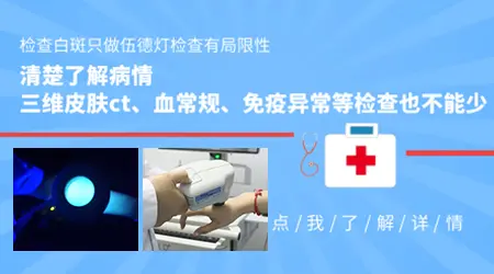 如何区分儿童白癜风与白色糠疹