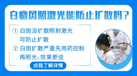 手部白斑每次照射308多长时间