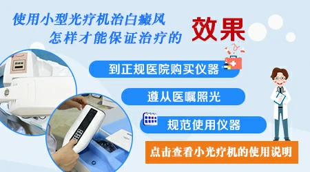 白癜风自己在家做光疗需要注意什么