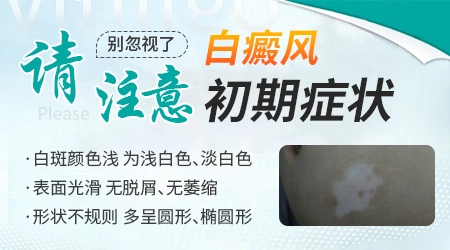 白癜风初征兆什么样图片