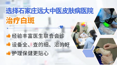 石家庄远大中医皮肤病医院哪个医生看白癜风好