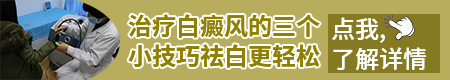 白癜风可不可以直接用遮盖液涂抹白斑