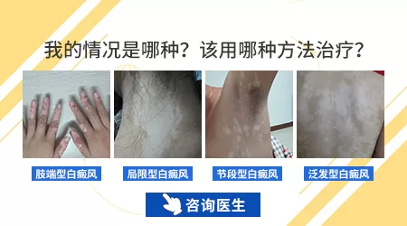 肢端型白斑为什么难治疗