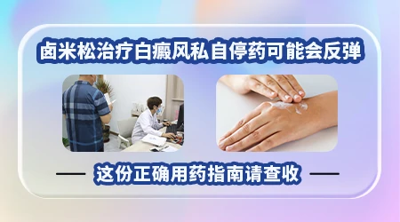 卤米松乳膏治疗白癜风多能用多久