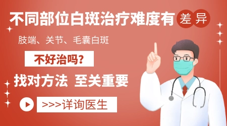 手部白癜风为什么比其他部位难治疗