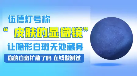 伍德灯下呈蓝白色边界清楚严重吗