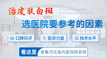 皮肤有白斑去石家庄哪家医院好