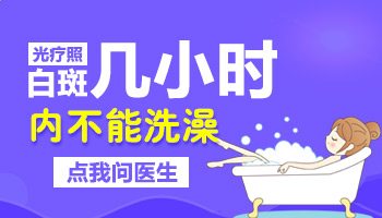 白癜风患者照308激光后多长时间能洗澡