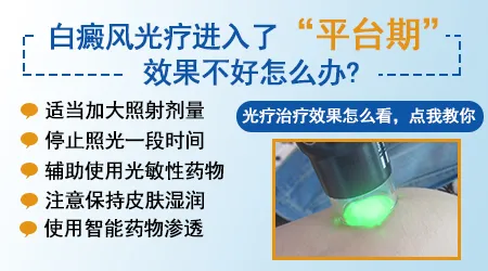 白癜风照光剂量一直加却没反应是不是没效果