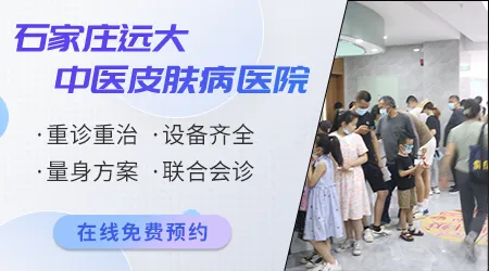 白癜风打复色针有没有治好的案例