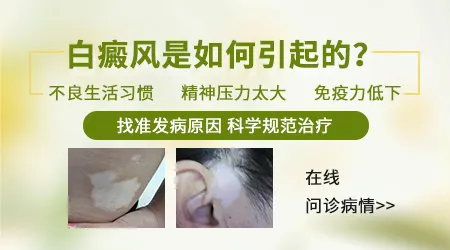 晕痣白斑是由于什么引起的