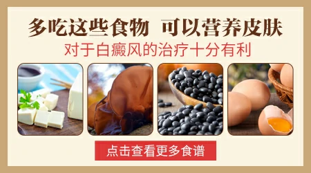 白癜风吃什么食物能够好转