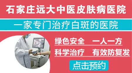 石家庄有没有专门治白癜风好的医院