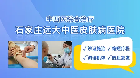 中医治疗白癜风的效果怎么样