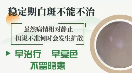 儿童白癜风多久不变大就没事
