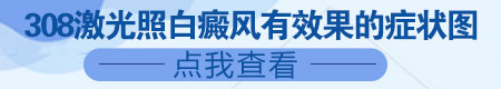 晕痣照308准分子激光痣要遮挡吗