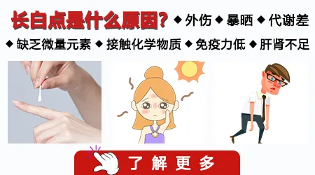 外伤后白斑和白癜风的区别图片