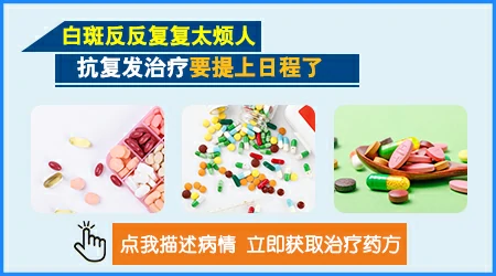白癜风抗复发吃多久的中药