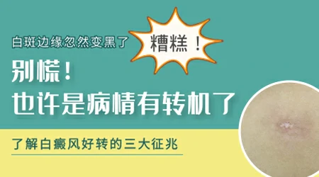 白癜风光疗期间白斑周围皮肤变黑正常吗