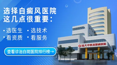 石家庄白癜风有名的医院