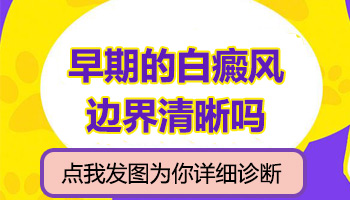 白癜风白斑边界很清楚是什么意思