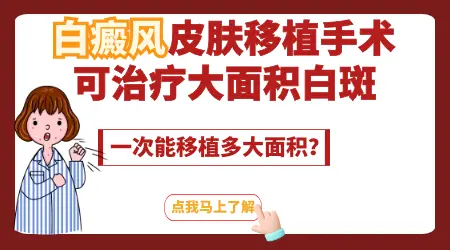 大面积白癜风做手术能治好吗